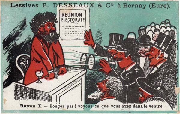 Lessives DESSEAUX - Rayon X - Bougez pas ! voyons ce que vous avez dans le ventre